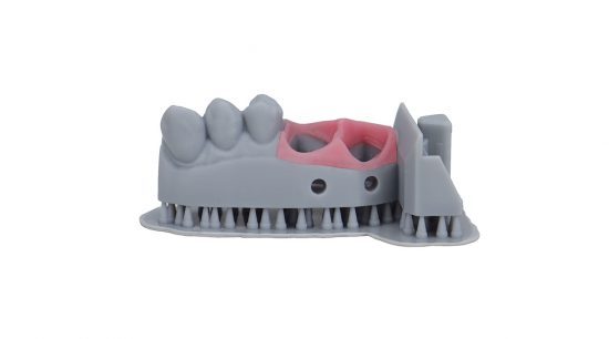 Use case Dental Model Pro Grey Partial Model with Gingiva Mask Resin for SLA DLP LCD MSLA 3D Printing