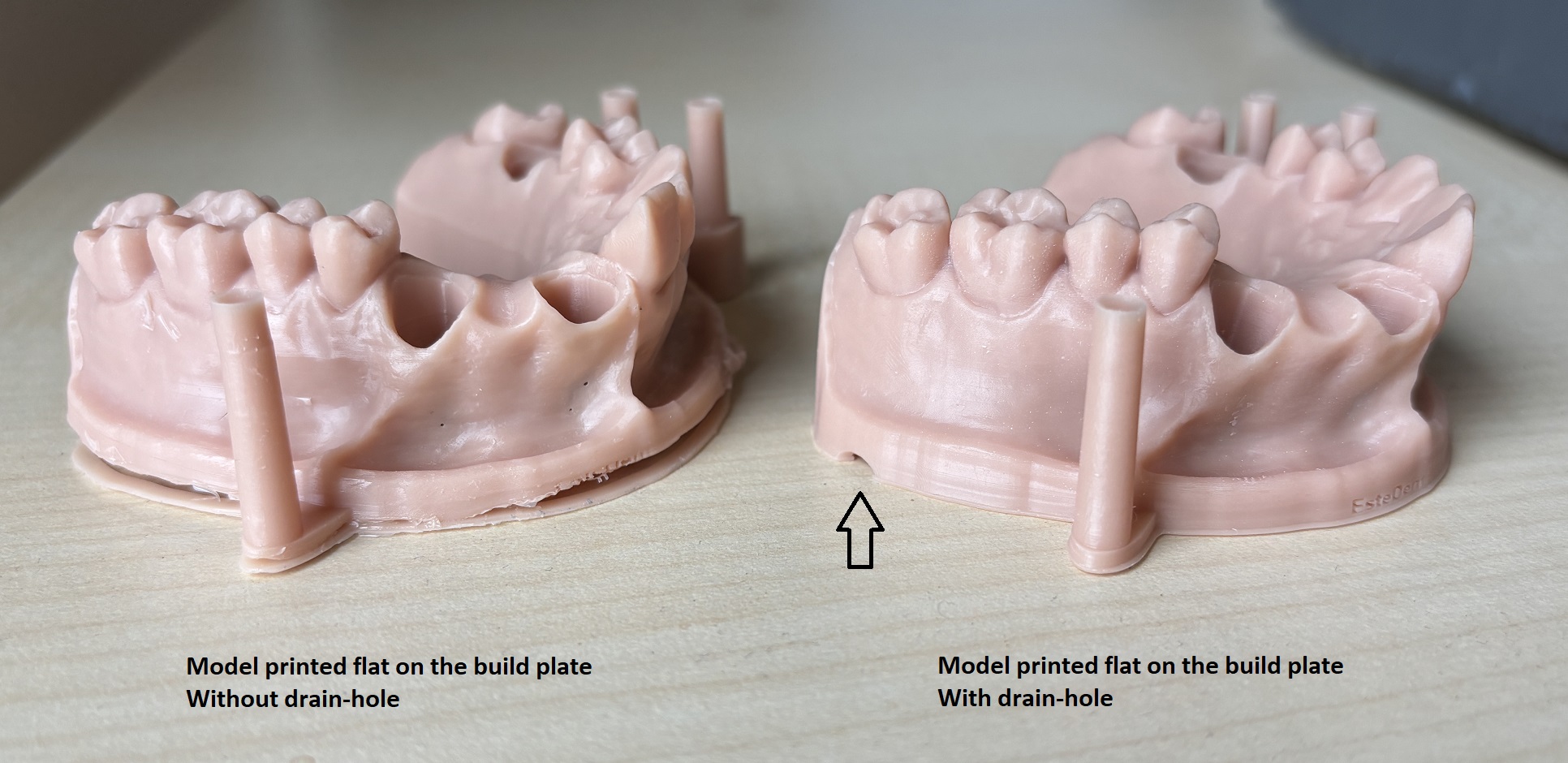 Premium Model with without drain hole liqcreate quality dental model aligner defect