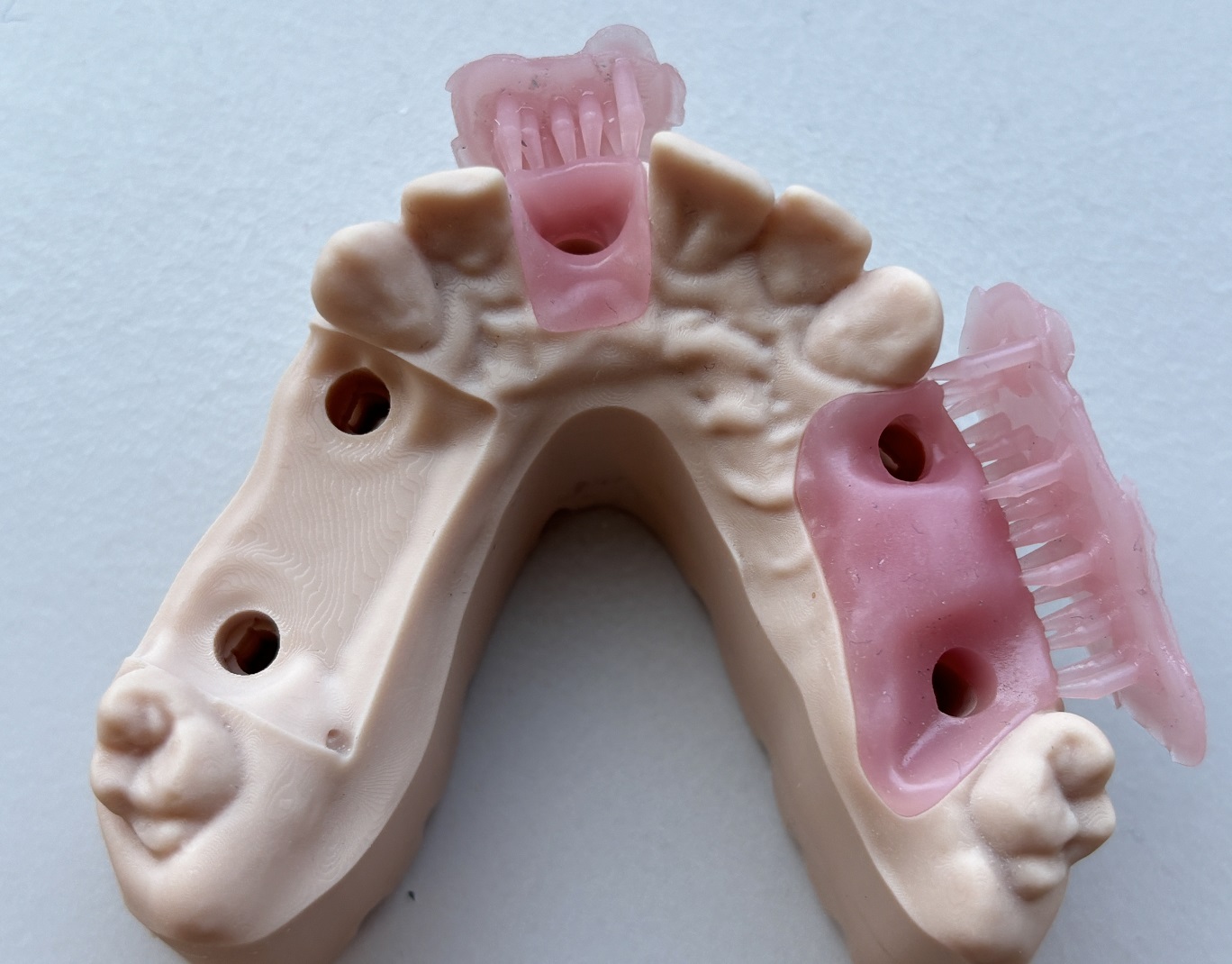 gingiva Mask on model on supports. after water curing perfect fit