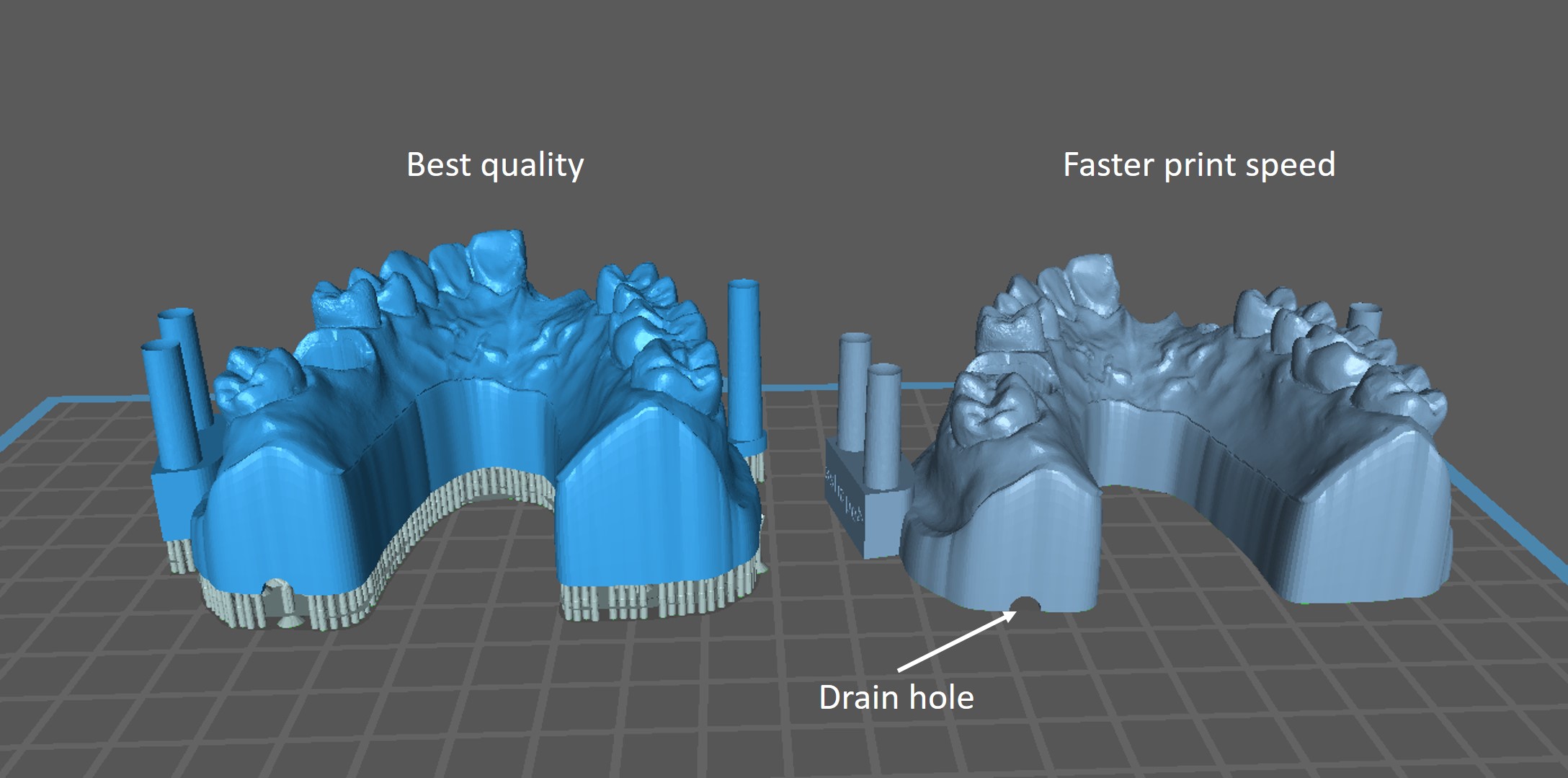 orientation and support liqcreate premium model aligner 3D-printing resin dentistry dental