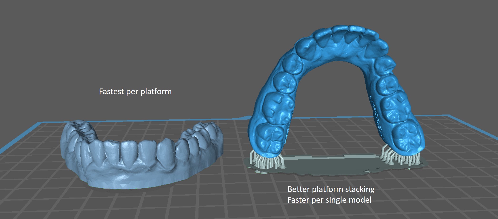 orientation and support liqcreate premium model aligner 3D-printing resin dentistry dental