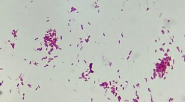 e. coli gramkleuring